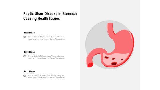 Peptic_Ulcer_Disease_In_Stomach_Causing_Health_Issues_Ppt_PowerPoint_Presentation_Infographic_Template_Format_Ideas_PDF_Slide_1.jpg