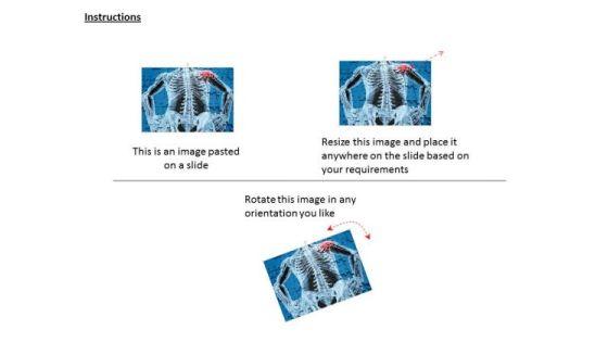 stock_photo_shoulder_with_pain_point_for_human_powerpoint_slide_2.jpg