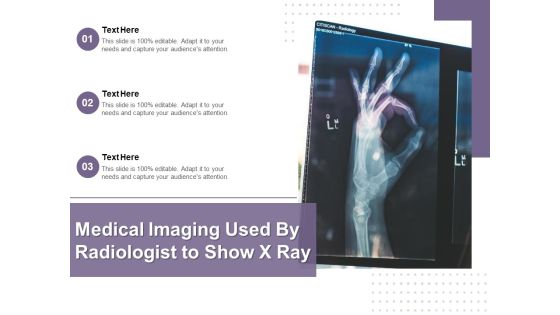 Medical Imaging Used By Radiologist To Show X Ray Ppt PowerPoint Presentation Gallery Show PDF Medical Imaging Used By Radiologist To Show X Ray Ppt PowerPoint Presentation Gallery Show PDF