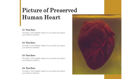 Picture Of Preserved Human Heart Ppt PowerPoint Presentation Professional Smartart PDF Picture Of Preserved Human Heart Ppt PowerPoint Presentation Professional Smartart PDF