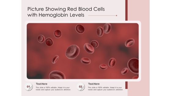 Picture Showing Red Blood Cells With Hemoglobin Levels Ppt PowerPoint Presentation File Templates PDF Picture Showing Red Blood Cells With Hemoglobin Levels Ppt PowerPoint Presentation File Templates PDF