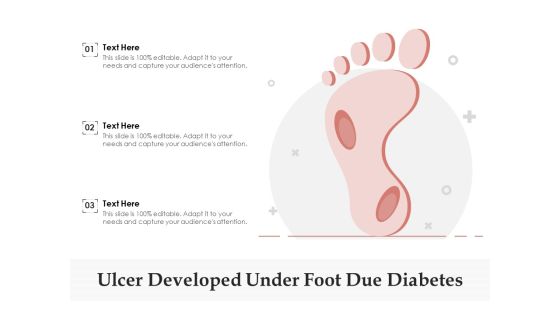 Ulcer Developed Under Foot Due Diabetes Ppt PowerPoint Presentation Pictures Objects PDF Ulcer Developed Under Foot Due Diabetes Ppt PowerPoint Presentation Pictures Objects PDF