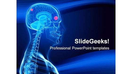 Brain Tumor Science PowerPoint Template 0610 Brain Tumor Science PowerPoint Template 0610