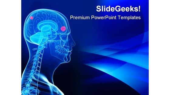 Cerebral Tumor Medical PowerPoint Templates And PowerPoint Backgrounds 0611 Cerebral Tumor Medical PowerPoint Templates And PowerPoint Backgrounds 0611