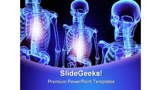 Skeleton Medical PowerPoint Template 1110