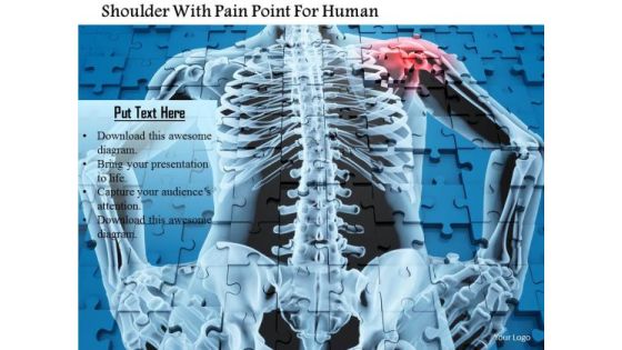 Stock Photo Shoulder With Pain Point For Human PowerPoint Slide Stock Photo Shoulder With Pain Point For Human PowerPoint Slide