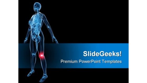 X Ray Of Painful Knee Medical PowerPoint Templates And PowerPoint Backgrounds 0811 X Ray Of Painful Knee Medical PowerPoint Templates And PowerPoint Backgrounds 0811
